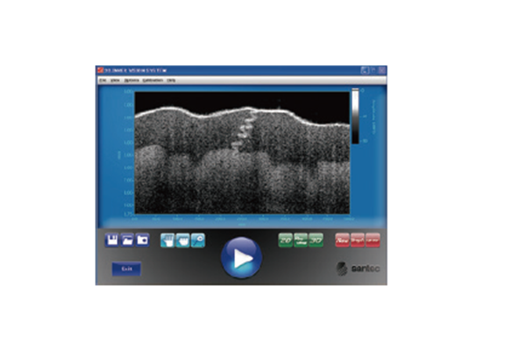OCT主控軟件Inner Vision Software